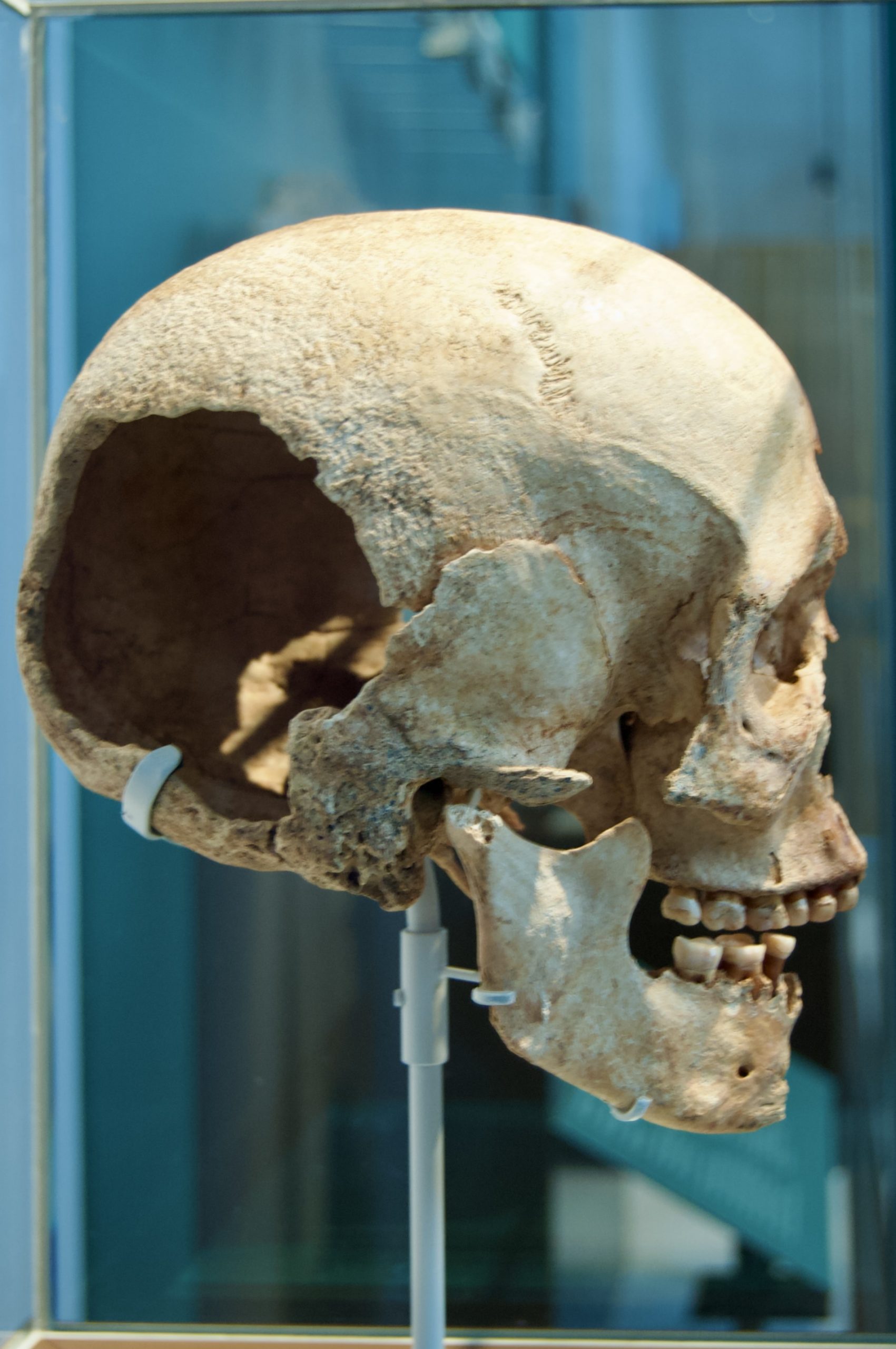 Skull